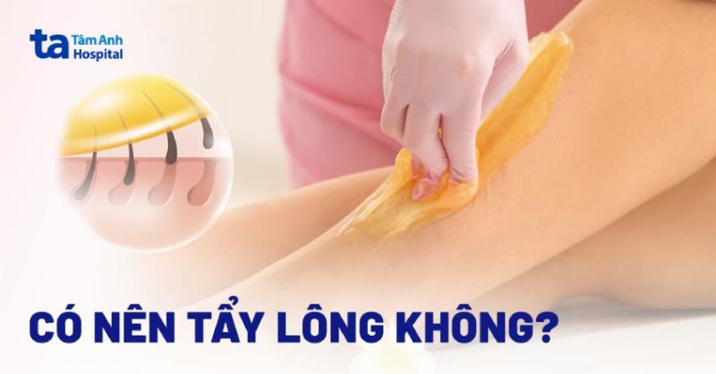 So sánh ưu nhược điểm của kem tẩy lông Veet, cạo lông và wax lông trên các tiêu chí: hiệu quả, đau đớn, thời gian mọc lại.